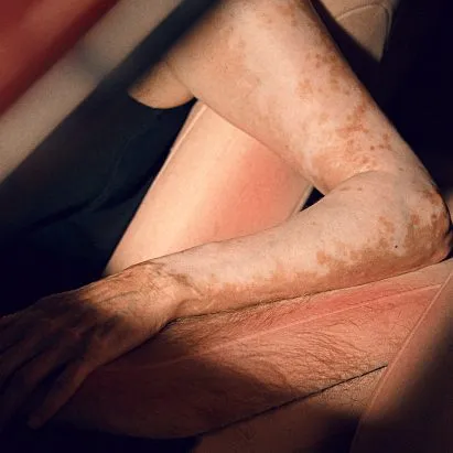 This car covered in human-like skin turns red in the sun - and that's kind of the point